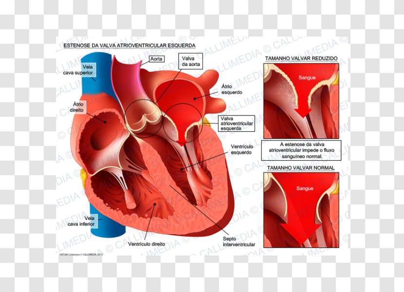 Aortic Insufficiency Aorta Stenosis Ventricle Valve - Watercolor - Heart Transparent PNG