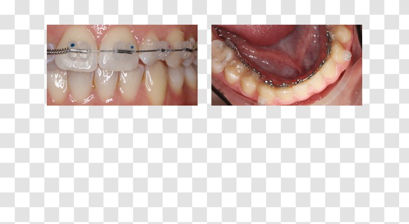 Close-up - Flower - Dental Treatment Transparent PNG
