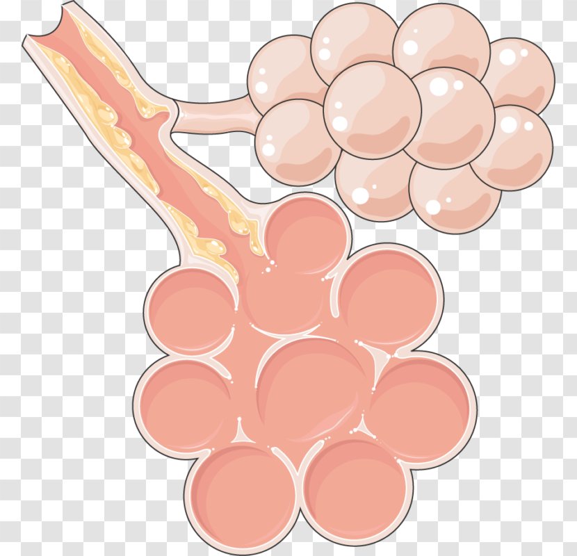 Chronic Bronchitis Pulmonology Lung Condition - Intrapulmonary Nodes - Specialty Transparent PNG