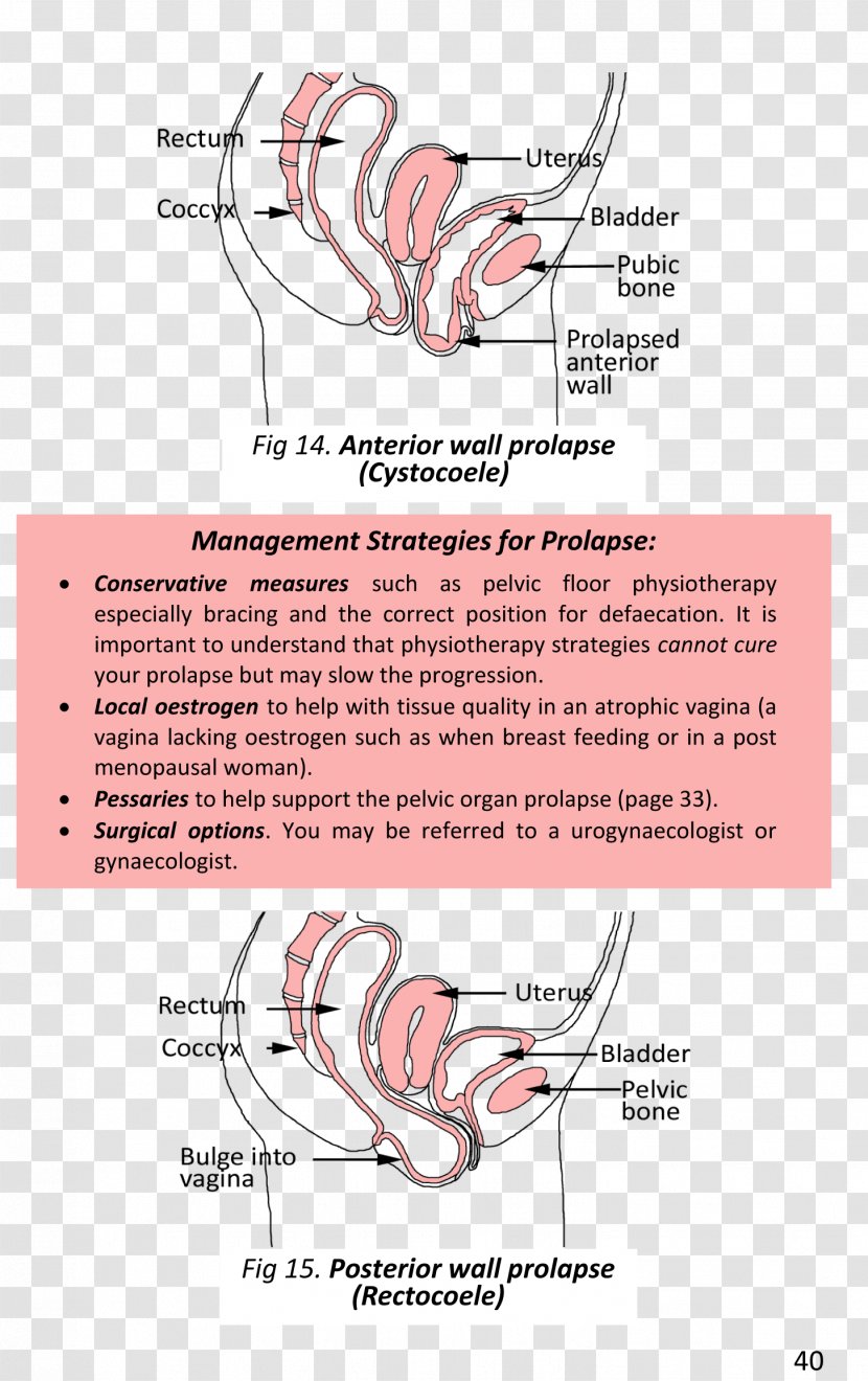 Surgery Book Pelvic Floor Gynaecology Physical Therapy - Watercolor Transparent PNG