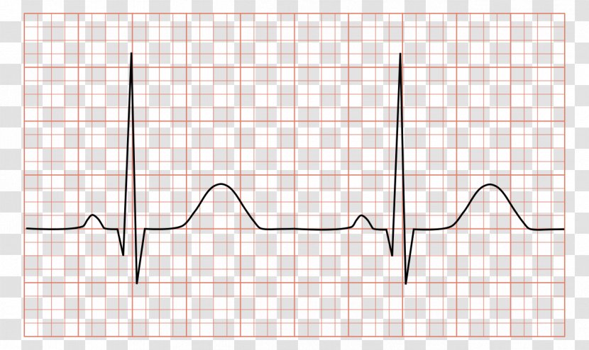 Electrocardiography QRS Complex Sinus Rhythm Heart Arrhythmia - Flower Transparent PNG