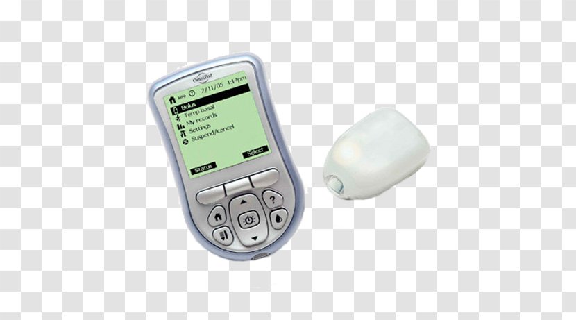 Insulin Pump Diabetes Mellitus Insulet Corporation - Hardware - Management Transparent PNG
