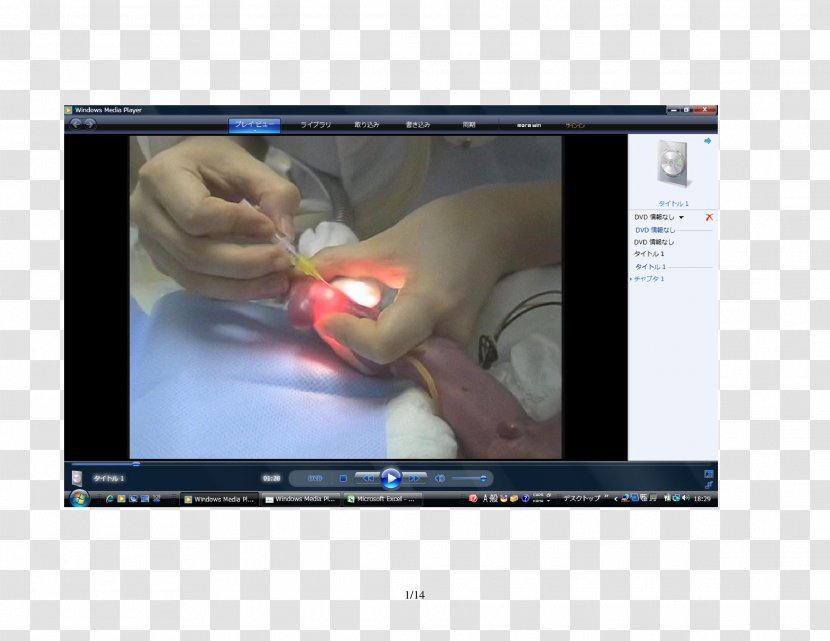 Computer Monitors Video Finger Multimedia Software - Hand - Catheter Transparent PNG