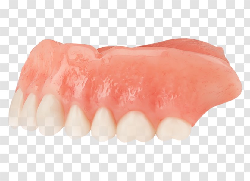 Dentures Tooth Dentistry Dental Implant - Bridge Transparent PNG