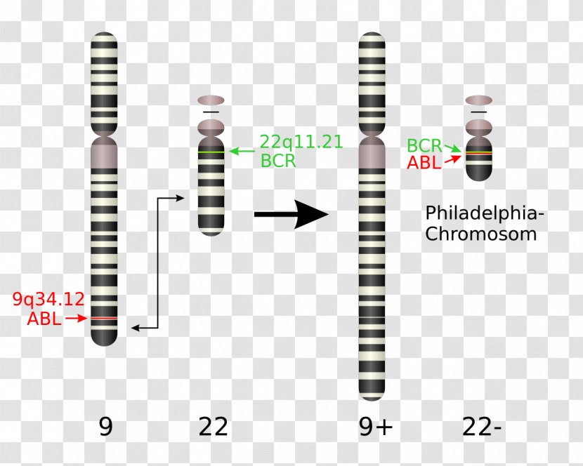 Philadelphia Chromosome Chromosomal Translocation Chronic Myelogenous Leukemia Abnormality - Vincristine Transparent PNG