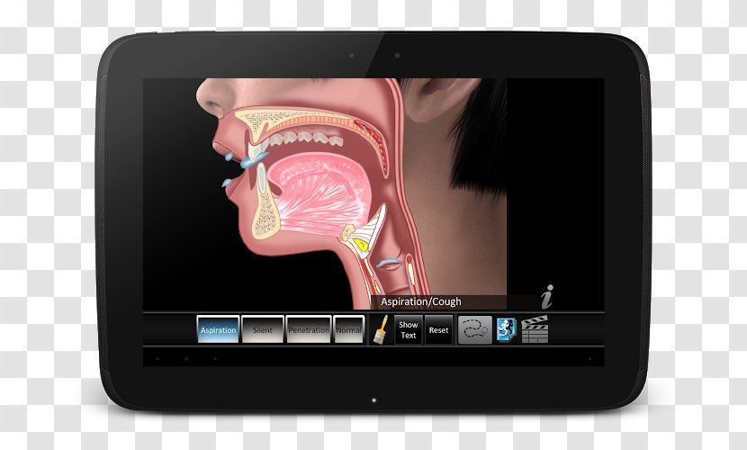 App Store Pulmonary Aspiration Apple Swallowing - Human Anatomy - Wa Transparan Apk Transparent PNG