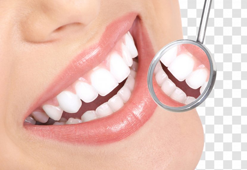 Tooth Whitening Decay Therapy Dentist - Teeth Cleaning - Smile HD Transparent PNG