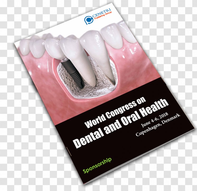 Controversial Issues In Implant Dentistry Advertising - Design Transparent PNG