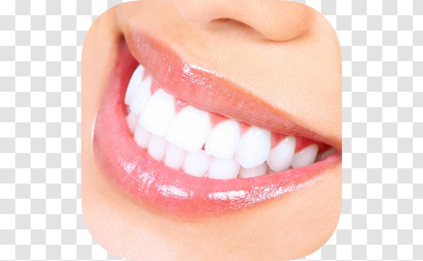 Tooth Whitening Dentistry Human - Cracked Syndrome - Healthy Teeth Transparent PNG