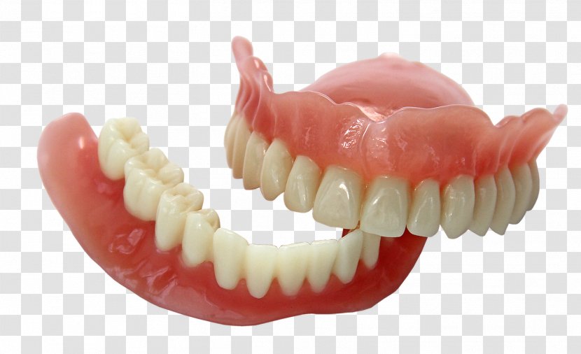 3D Printing Dentures EnvisionTEC Dentistry - Tooth - Dental Transparent PNG
