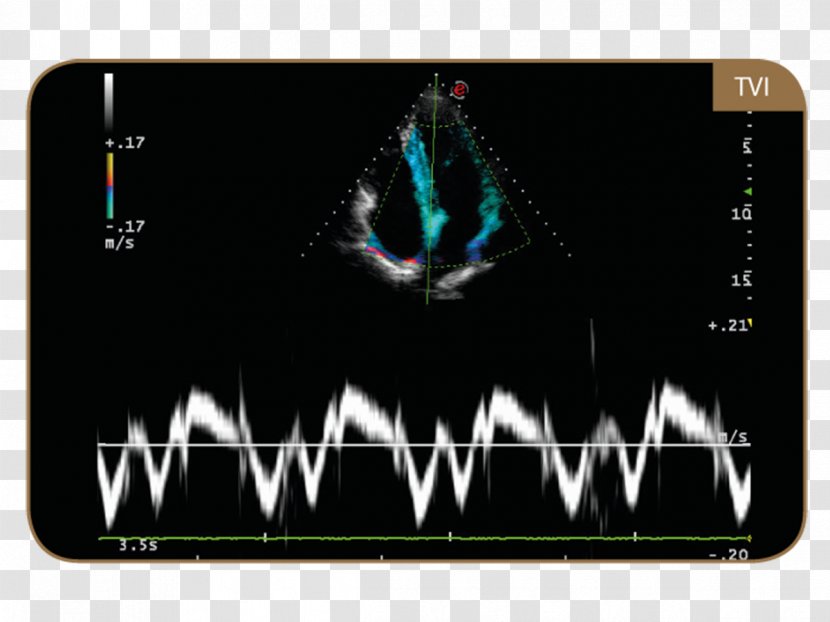 Ultrasonography Tissue Doppler Echocardiography Ultrasound Esaote Technology - Brand Transparent PNG