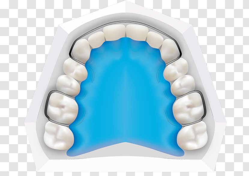 Tooth Orthodontics Dental Braces Dentistry Orthodontist - Child Transparent PNG