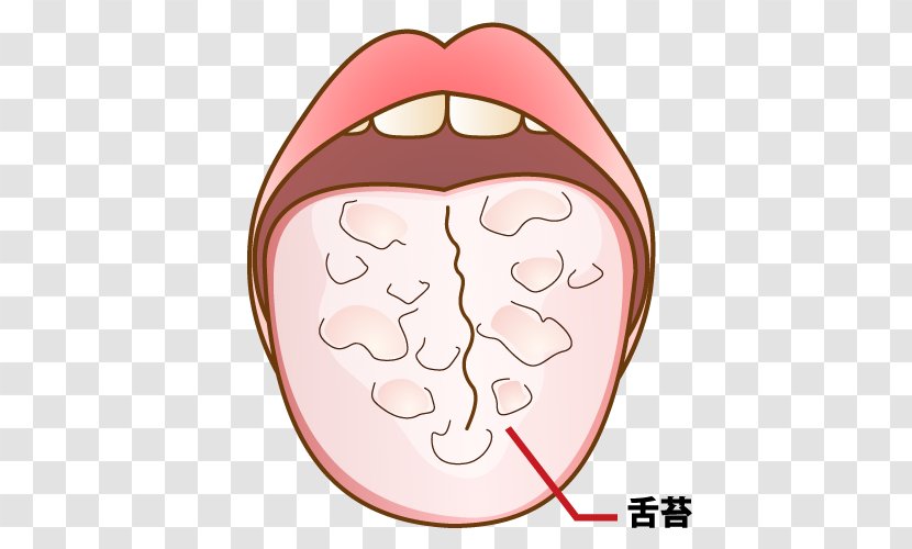 Mouthwash 歯科 Dentist 坂井医院 Tooth Decay - Flower - Tongue Transparent PNG