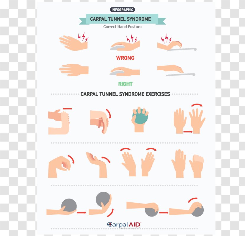 Carpal Tunnel Syndrome Exercise Hand Wrist Pain - Surgery Transparent PNG