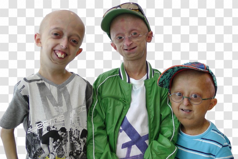 Progeria Disease Syndrome Child Netherlands - Tree - College Night Transparent PNG