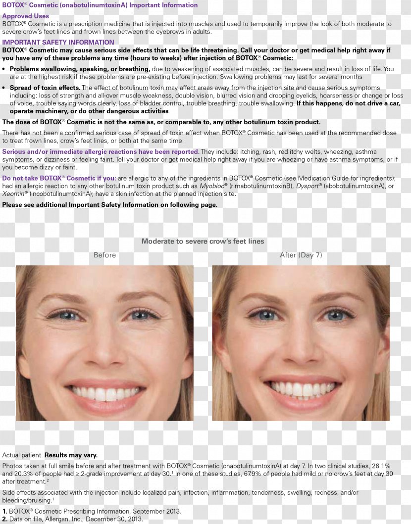 Botulinum Toxin Wrinkle Truly Skin Injection Forehead - Hair Coloring - Headache Transparent PNG