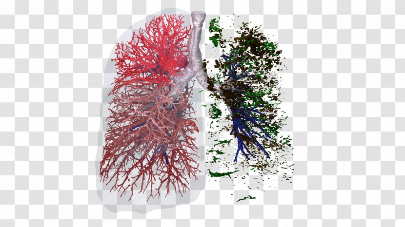 Clinical Trial Lung Respiratory System FLUIDDA Nv Information - Algorithm Transparent PNG