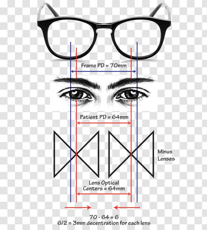 Glasses L'Optique Optometry Lens Astigmatism - Tree Transparent PNG