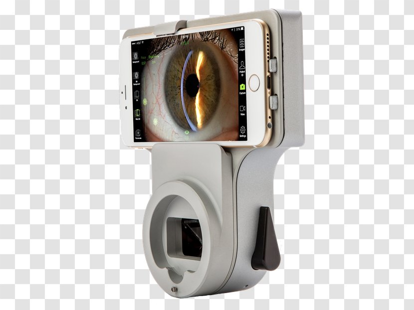Image-forming Optical System Medical Imaging Technology - Computer Hardware - Slit Lamp Exam Transparent PNG