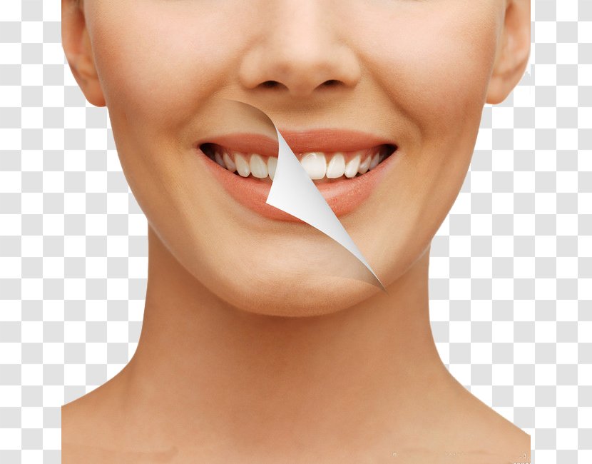 Cosmetic Dentistry Tooth Whitening Human - Therapy - Teeth Transparent PNG