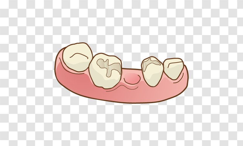Dentist Tooth Bridge Dentures 人工歯 - Pink Transparent PNG