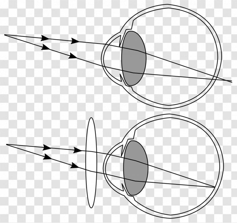 Far-sightedness Eye Visual Disturbances Perception Presbyopia - Watercolor Transparent PNG