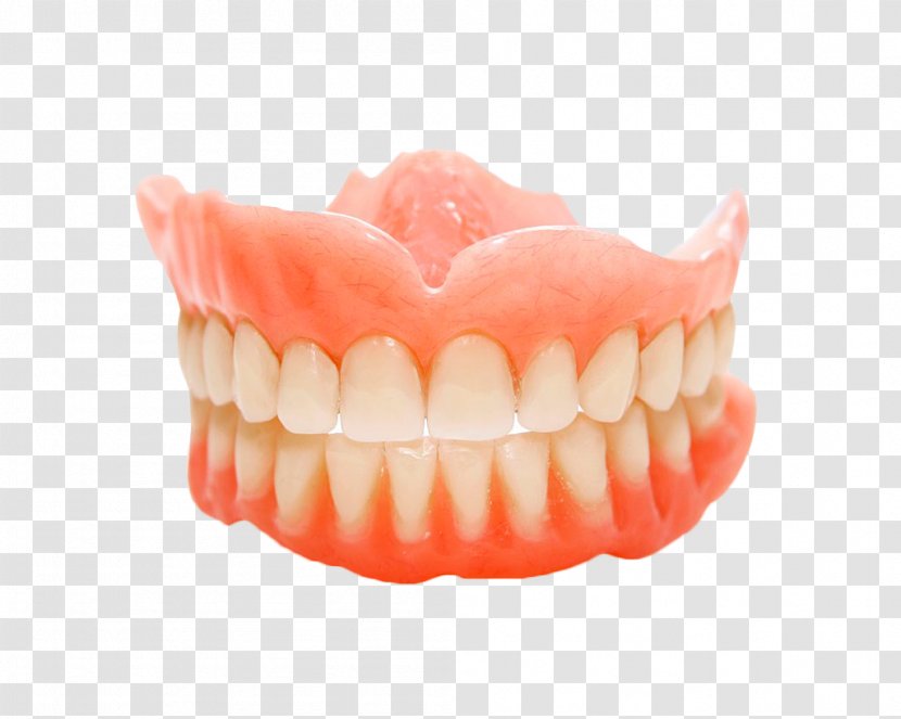 Dentures Removable Partial Denture Dental Implant Dentistry - Cosmetic - Hand Painted Teeth Transparent PNG