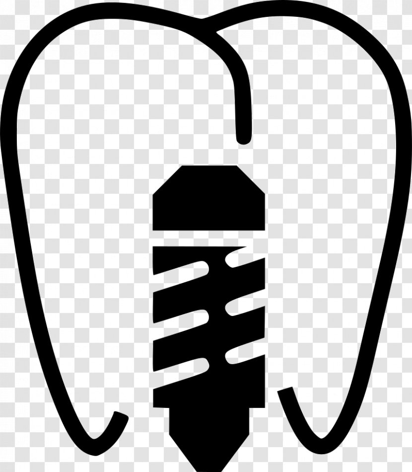 Cosmetic Dentistry Dental Implant Tooth - Medicine Transparent PNG