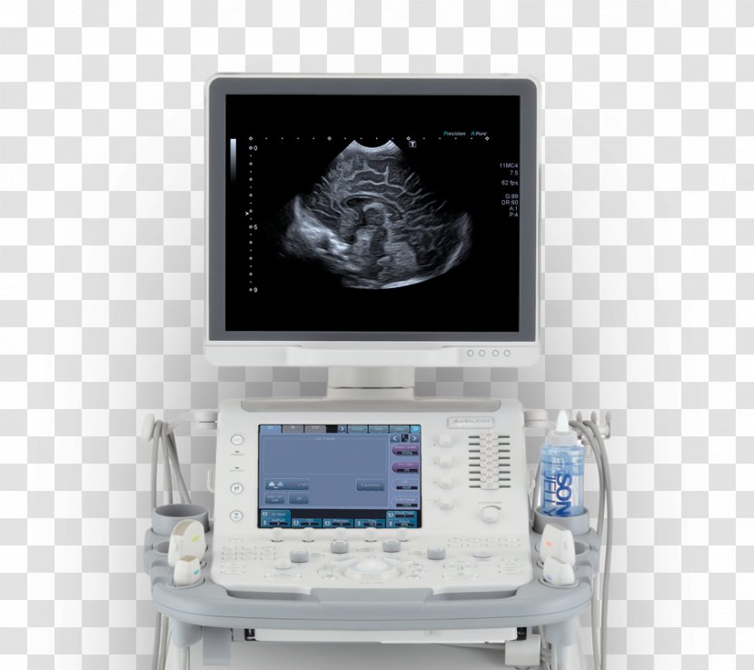 Ultrasonography Ultrasound Medical Diagnosis Patient Mindray - System - Health Care Transparent PNG