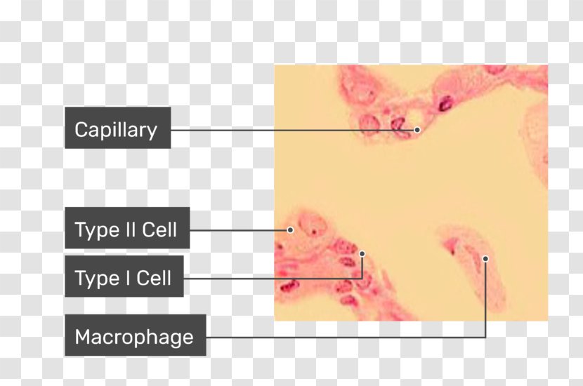 Alveolar Macrophage Pulmonary Alveolus Cell Lung - Human Body - Microscope Transparent PNG