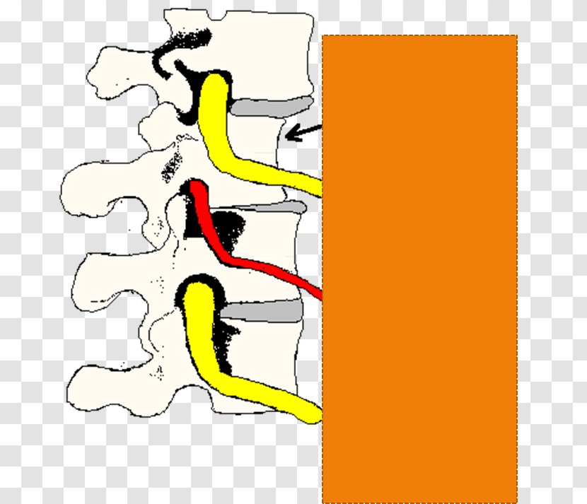 Phoenix Mountain Chiropractic Life Center Spinal Adjustment Vertebral Subluxation - Watercolor - Tree Transparent PNG