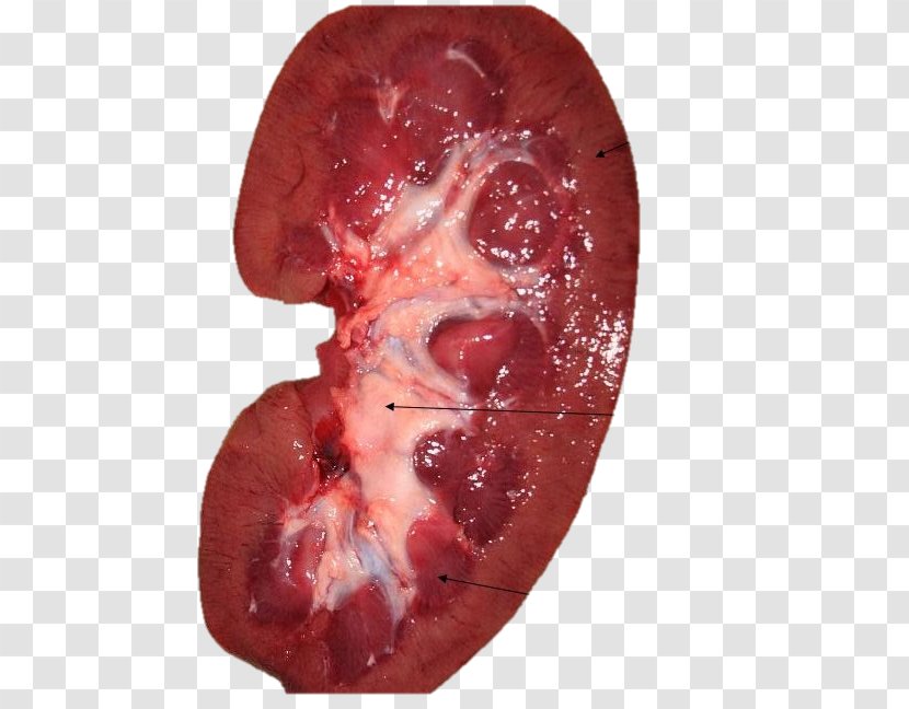 Kidney Nephron Blood Bowman's Capsule Ureter - Heart - Real Doctors Transparent PNG