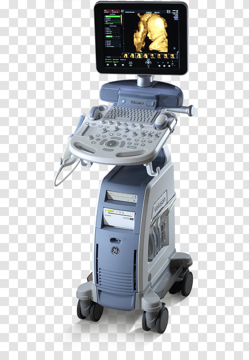 Voluson 730 Ultrasonography Ultrasound GE Healthcare Gynaecology - Health Care - Medical Diagnosis Transparent PNG