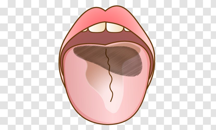 歯科 Dentist Tongue Mouth Bad Breath - Heart Transparent PNG
