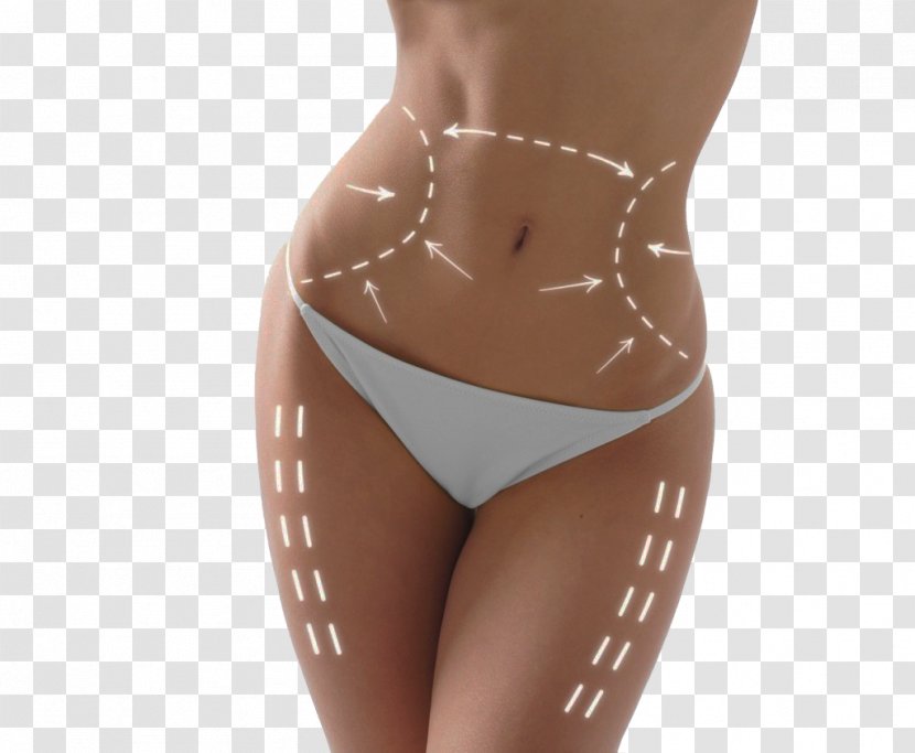 Body Contouring Cryolipolysis Non-surgical Liposuction Surgery - Tree - Cartoon Transparent PNG