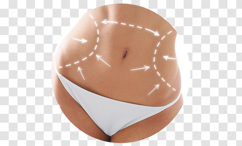 Liposuction Plastic Surgery Human Body Medicine - Silhouette - Milano Transparent PNG
