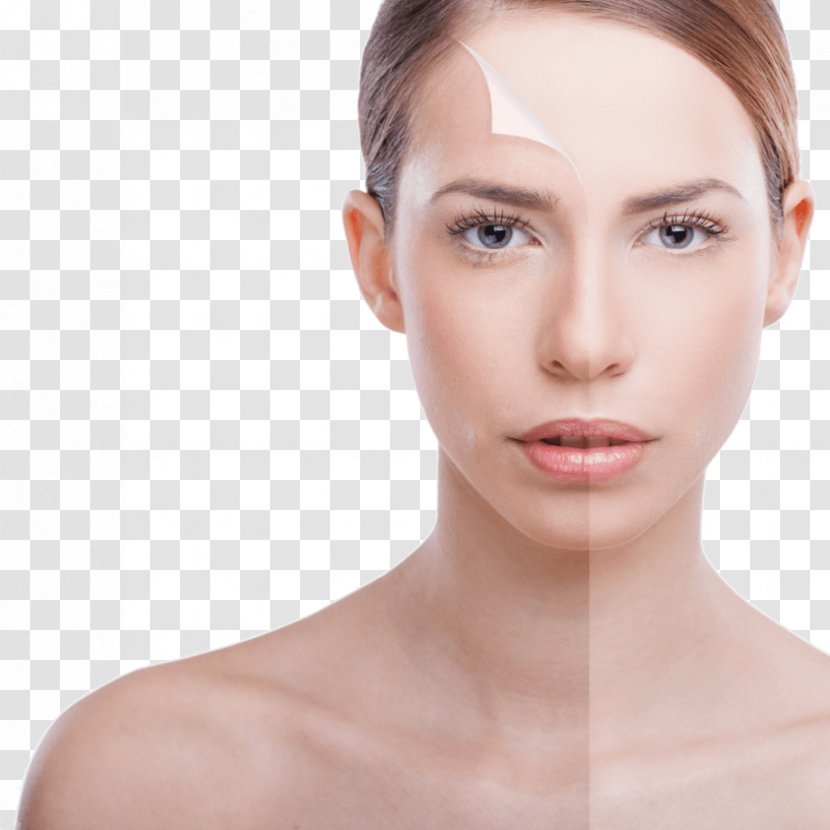 Chemical Peel Exfoliation Facial Photorejuvenation Beauty Parlour - Glycolic Acid - Plump Transparent PNG