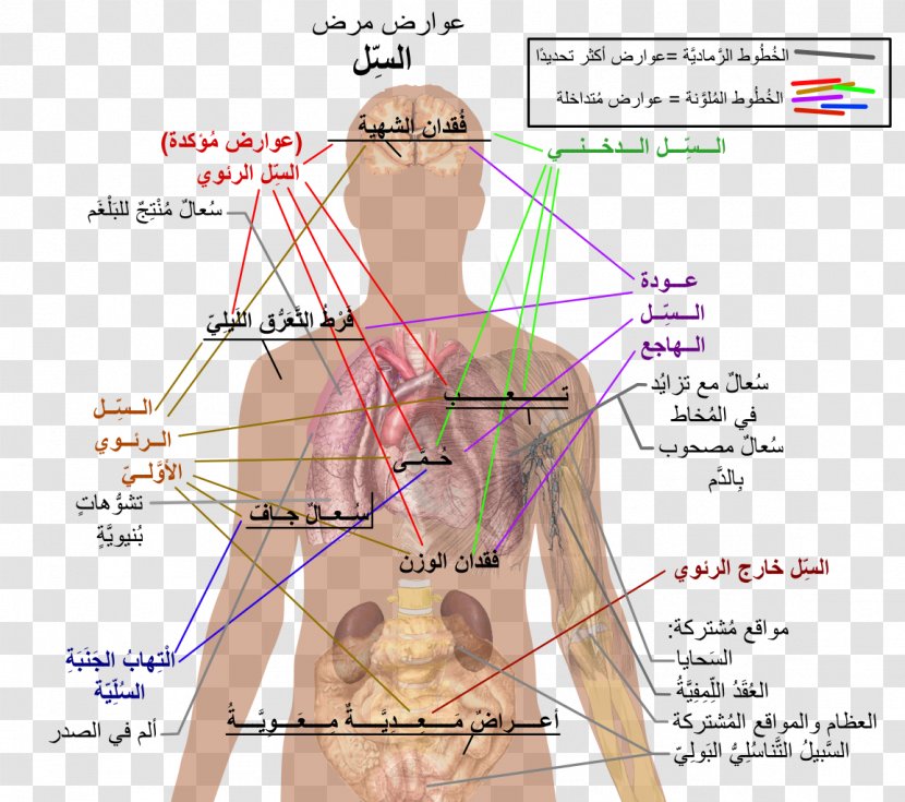 Mycobacterium Tuberculosis Infection Disease Symptom - Frame - Health Transparent PNG