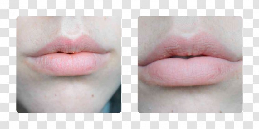 Lip Gloss Close-up - Chin - Sos Hydration Inc Transparent PNG