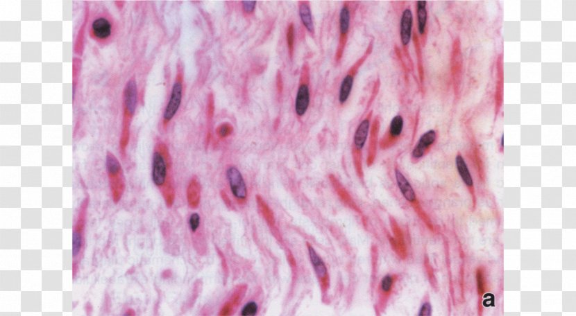 Mesenchyme Connective Tissue Extracellular Matrix - Umbilical Cord - Irregular Border Transparent PNG