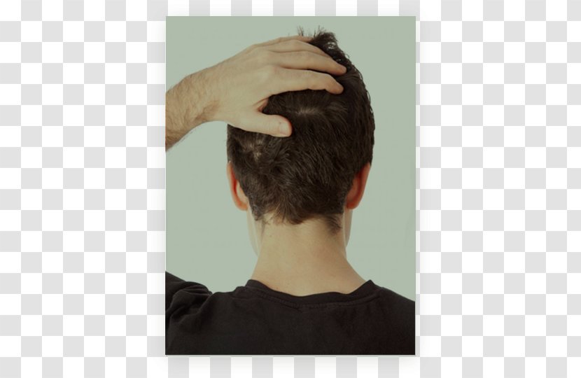 Scalp Nape Headache Pain Hair Loss - Disease Transparent PNG