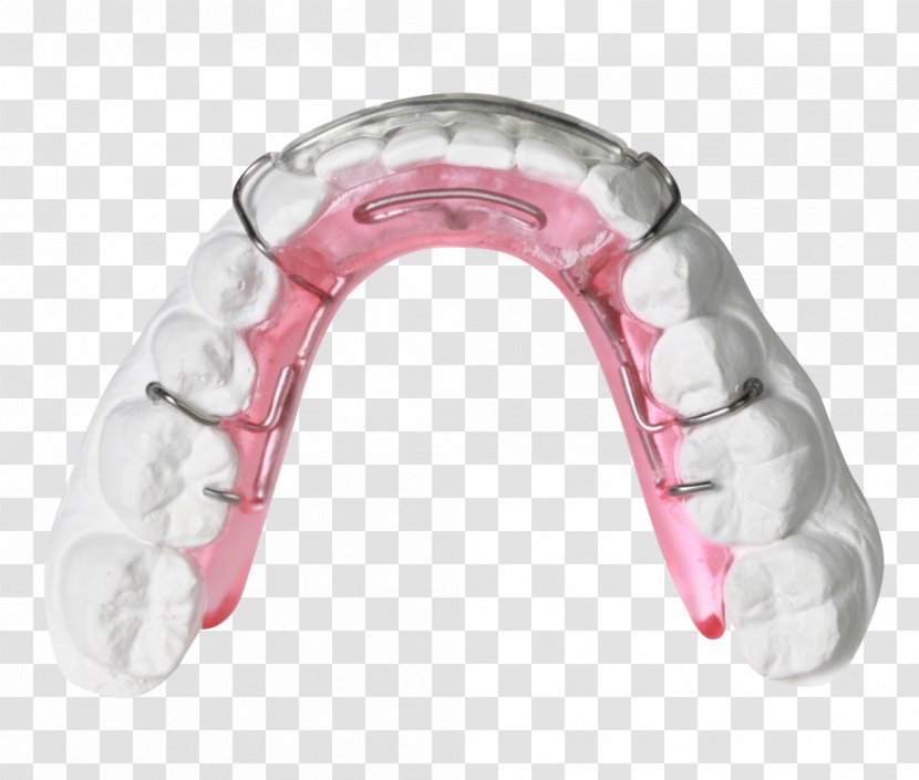 Clear Aligners Orthodontics Orthodontic Technology Jaw Bionator - Photo Albums Transparent PNG