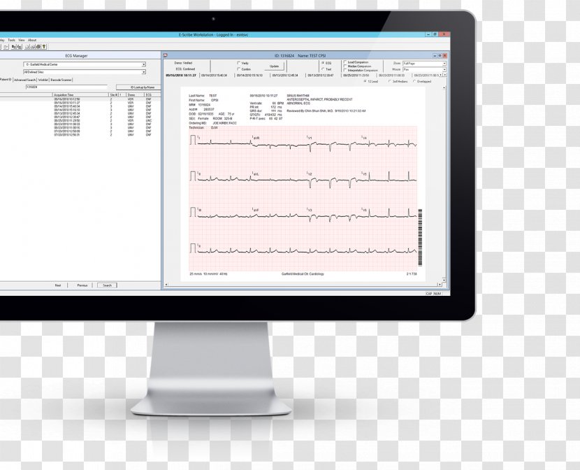 Information Electrocardiography Welch Allyn CPR-UI-UB-D PC-Based Resting ECG Interpretive Software ABPM-6100S Cardioperfect 6100-Series ABPM Management - Screen Transparent PNG