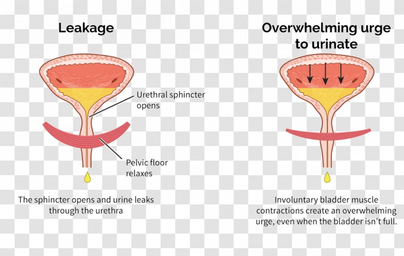 Overactive Bladder Urinary Incontinence Urethral Sphincters - Spasm - Training Transparent PNG