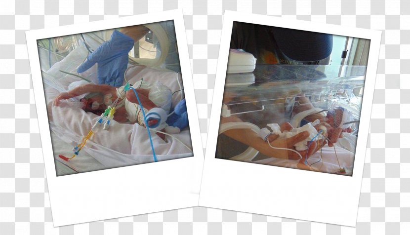 Queen Elizabeth University Hospital Neonatal Intensive Care Unit Infant Birth Plastic - Incubator Transparent PNG
