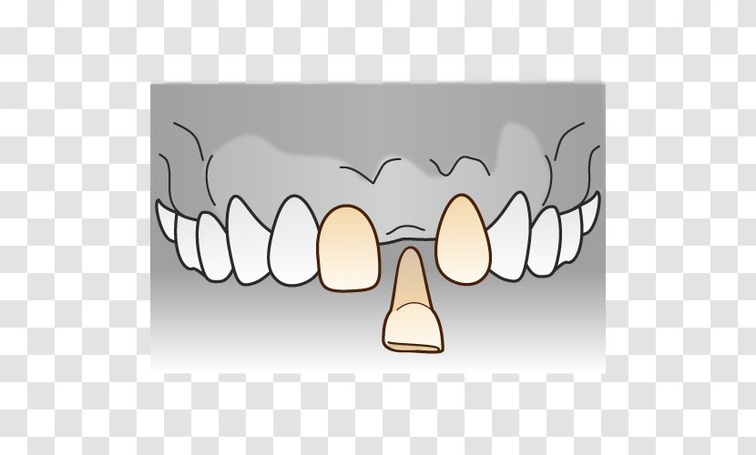 Tooth Dentist Dentures 審美歯科 - Heart - Bridge Transparent PNG