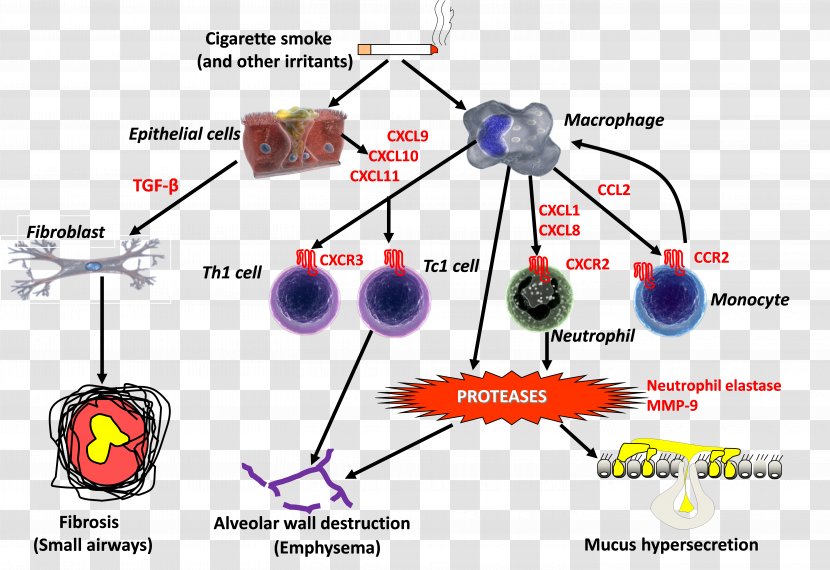 Acute Exacerbation Of Chronic Obstructive Pulmonary Disease Inflammation Eosinophil - Technology Transparent PNG
