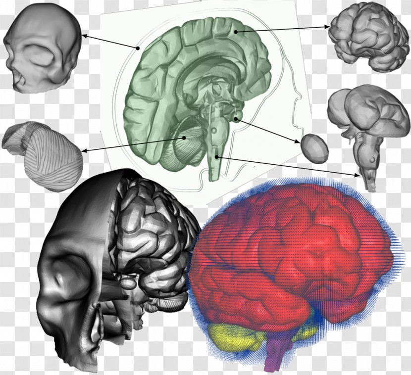 Traumatic Brain Injury Concussion Amnesia Neurosurgery - Silhouette Transparent PNG