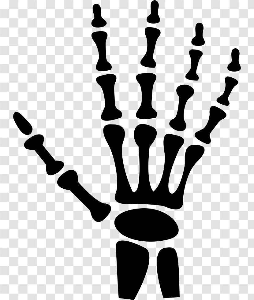 Hand X-ray Radiology Human Body - Black And White Transparent PNG