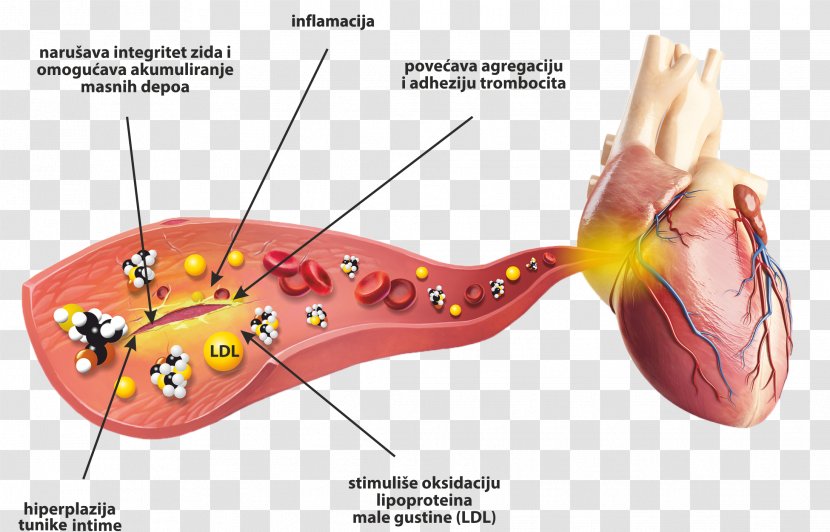 Homocysteine Blood Health Cardiovascular Disease Heart - Cartoon Transparent PNG